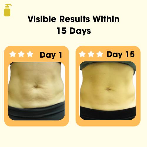 Vemnio - Anti Cellulite Massage Oil